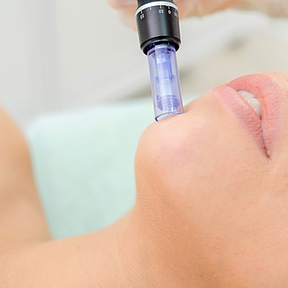 MICRONEEDLING BOTTOM